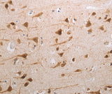 Anti-Human MDC1 Antibody - ABMIUM