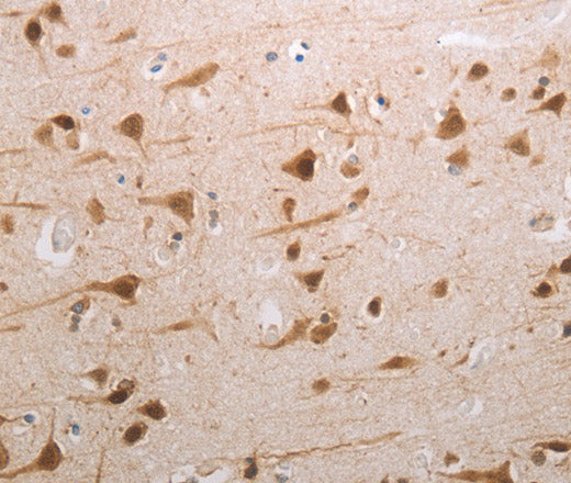 Anti-Human MDC1 Antibody - ABMIUM