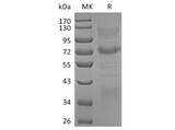 Recombinant Human Clusterin/ApoJ Protein (Fc & His Tag) - ABMIUM