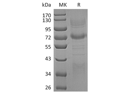 Recombinant Human Clusterin/ApoJ Protein (Fc & His Tag) - ABMIUM