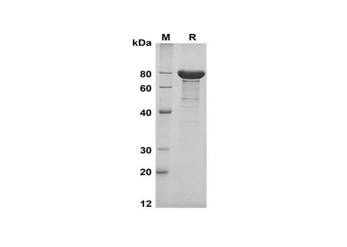 SDS-PAGE analysis of Human CDH1 proteins, 2 μg/lane of Recombinant Human CDH1 proteins was resolved with SDS-PAGE under reducing conditions, showing bands at 75-80 kDa.