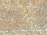 Immunohistochemistry of paraffin-embedded Human tonsil tissue using NAPRT Polyclonal Antibody at dilution of 1:50(×200)