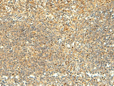 Immunohistochemistry of paraffin-embedded Human tonsil tissue using NAPRT Polyclonal Antibody at dilution of 1:50(×200)