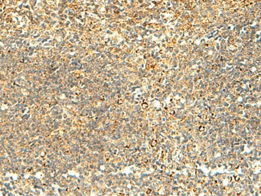 Immunohistochemistry of paraffin-embedded Human tonsil tissue using NAPRT Polyclonal Antibody at dilution of 1:50(×200)