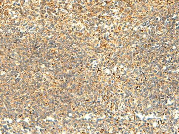 Immunohistochemistry of paraffin-embedded Human tonsil tissue using NAPRT Polyclonal Antibody at dilution of 1:50(×200)