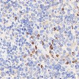 Immunohistochemistry analysis of paraffin-embedded mouse spleen using CYBB Polyclonal Antibody at dilution of 1:400.
