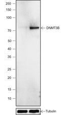 Anti-Human DNMT3B Antibody [A790] - ABMIUM