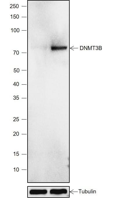 Anti-Human DNMT3B Antibody [A790] - ABMIUM