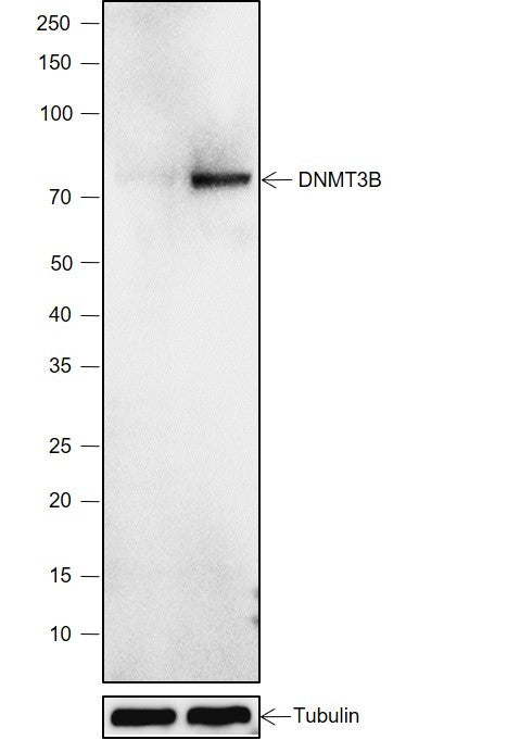 Anti-Human DNMT3B Antibody [A790] - ABMIUM