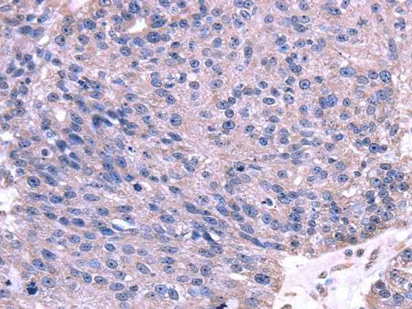 Anti-Human/Mouse TRIM14 Antibody