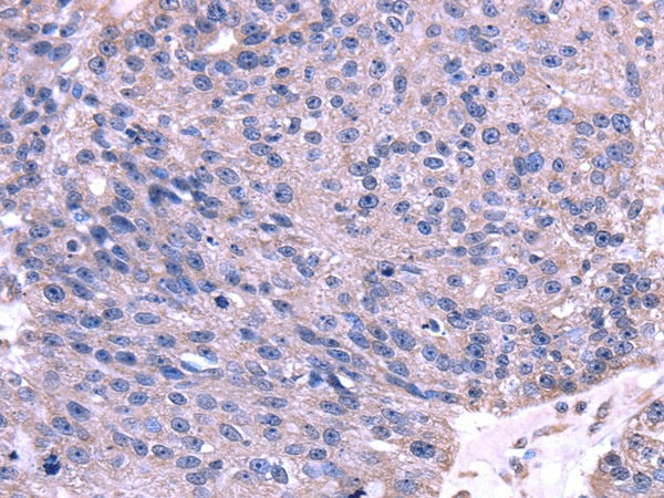 Anti-Human/Mouse TRIM14 Antibody - ABMIUM