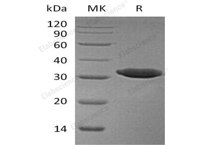 Recombinant Human Esterase D/ESD Protein (His Tag) - ABMIUM