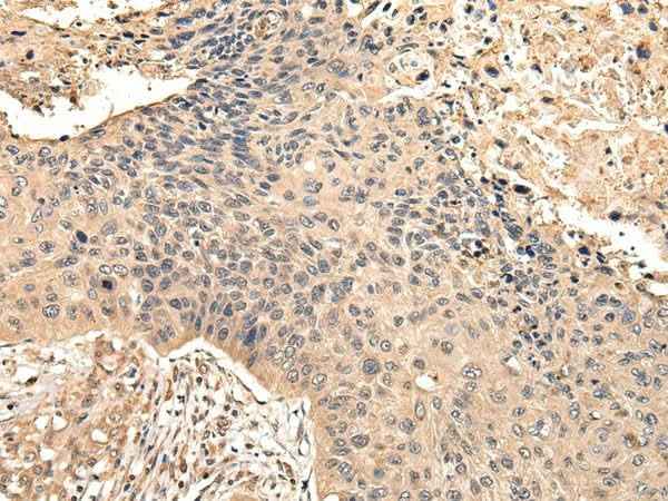 Anti-Human/Mouse VPS35 Antibody