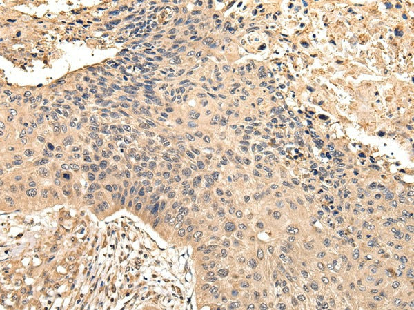 Anti-Human/Mouse VPS35 Antibody - ABMIUM