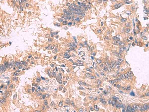Anti-Human/Mouse/Rat TJP1 Antibody