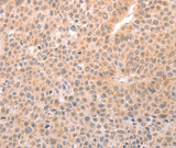 Anti-Human/Mouse/Rat TRPC3 Antibody - ABMIUM