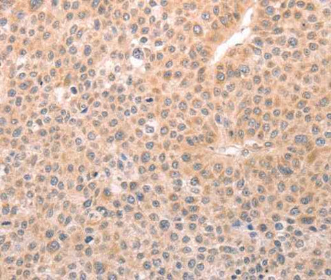 Anti-Human/Mouse/Rat TRPC3 Antibody