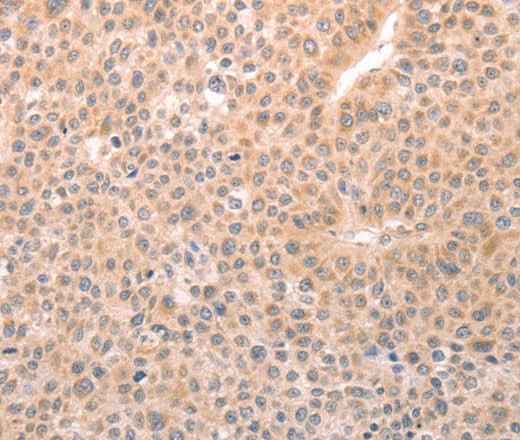 Anti-Human/Mouse/Rat TRPC3 Antibody