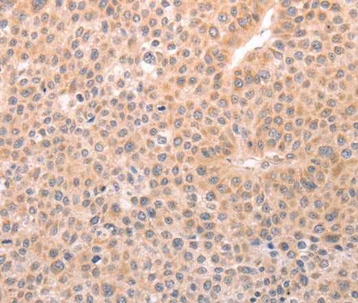 Anti-Human/Mouse/Rat TRPC3 Antibody - ABMIUM