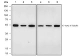 Anti-Human/Rat/Mouse beta II Tubulin Antibody [A592]