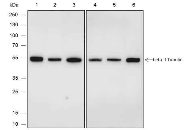 Anti-Human/Rat/Mouse beta II Tubulin Antibody [A592] - ABMIUM