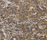 Anti-Human/Mouse KIF4A Antibody - ABMIUM