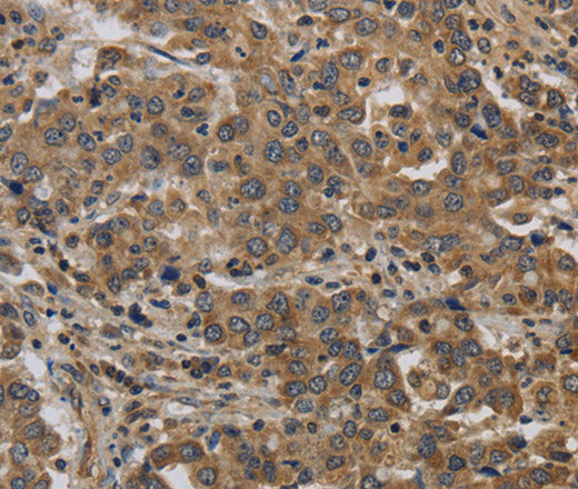 Anti-Human/Mouse KIF4A Antibody - ABMIUM