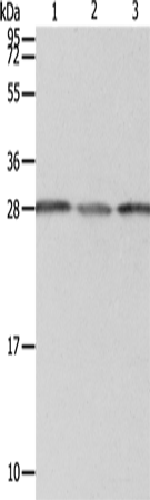 Anti-Human/Mouse/Rat PSMD9 Antibody - ABMIUM