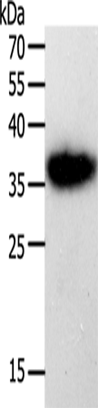 Anti-Human PLAUR Antibody - ABMIUM