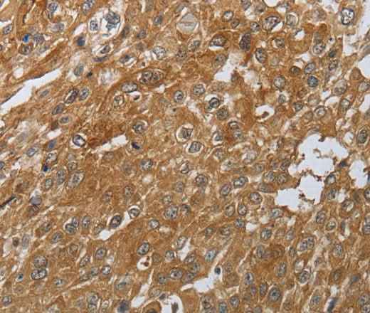 Anti-Human/Mouse PTPRM Antibody