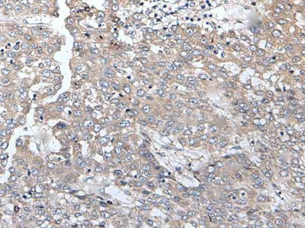 Anti-Human/Mouse BRMS1L Antibody