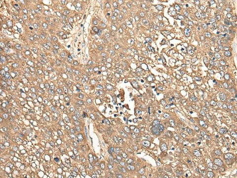 Anti-Human/Mouse/Rat CALB1 Antibody - ABMIUM