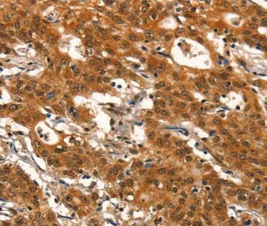 Anti-Human DEAF1 Antibody