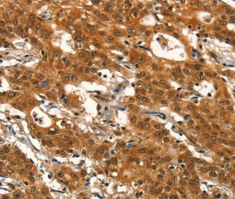 Anti-Human DEAF1 Antibody - ABMIUM