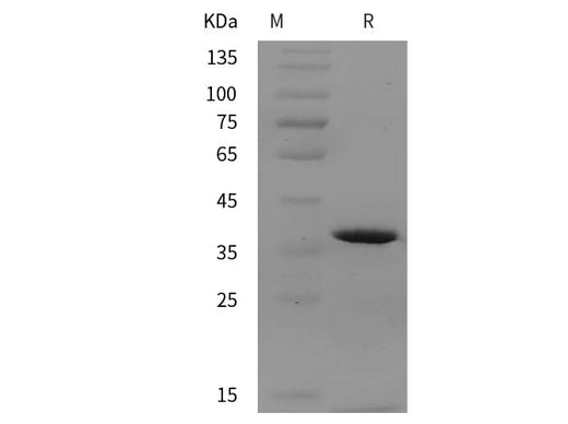 SDS-PAGE analysis of Human PRRG4 proteins, 2 μg/lane of Recombinant Human PRRG4 proteins was resolved with SDS-PAGE under reducing conditions, showing bands at 36 kDa.