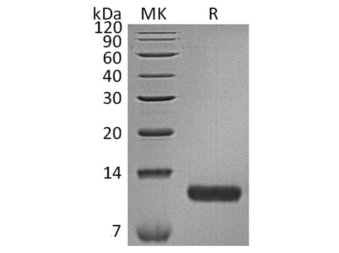 Recombinant Human CCL17/TARC Protein (His Tag) - ABMIUM