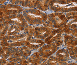 Anti-Human NCR1 Antibody - ABMIUM
