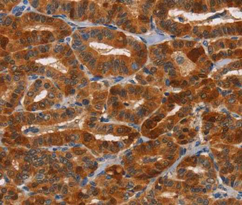 Anti-Human NCR1 Antibody