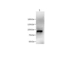 Anti-Mouse CD105 Antibody - ABMIUM