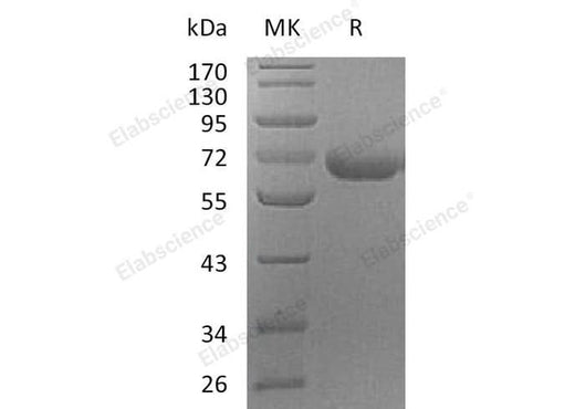 Recombinant Human PRCP Protein (His Tag) - ABMIUM