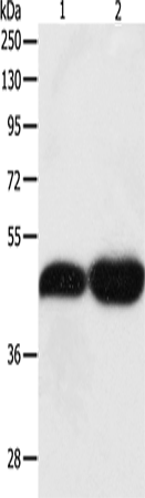 Anti-Human/Mouse/Rat TEKT1 Antibody - ABMIUM