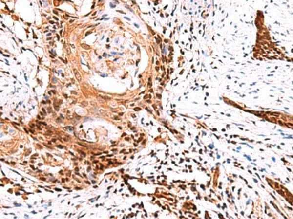 Anti-Human/Mouse/Rat TSEN2 Antibody