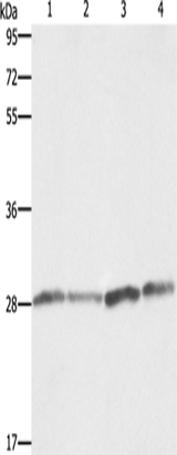 Anti-Human/Mouse BCAP31 Antibody - ABMIUM