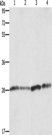 Anti-Human/Mouse BCAP31 Antibody - ABMIUM