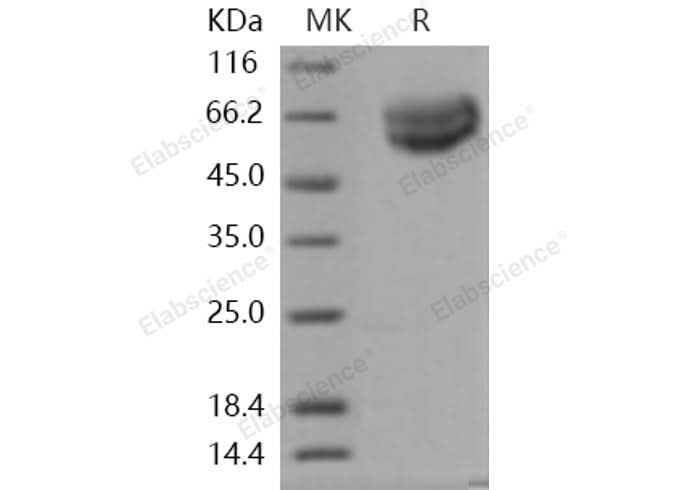 Recombinant Human IL18R1/CD218a Protein (His Tag) - ABMIUM