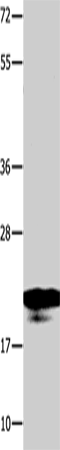 Anti-Human/Mouse/Rat NME1 Antibody - ABMIUM