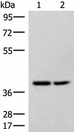 Western blot analysis of Hela and 231 cell lysates using HPDL Polyclonal Antibody at dilution of 1:400