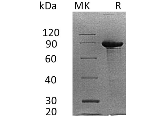Recombinant Human Syndecan-1/SDC1 Protein (Fc Tag) - ABMIUM