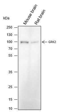 Anti-Human/Rat/Mouse GRK2 Antibody [A240] - ABMIUM