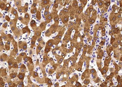 Anti-Human GOT2 Antibody [A919] - ABMIUM